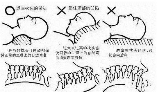 富贵包消除的方法图