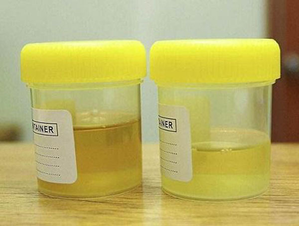 国内最好的垃圾处理器_垃圾处理器现在市场怎么样_垃圾处理器哪个国家的好