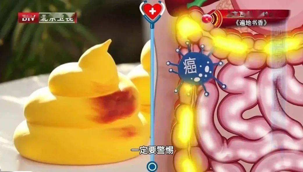 肛门拉大便出鲜血是怎么回事_大便出鲜血便后肛门疼怎么回事_大便出血肛门有血