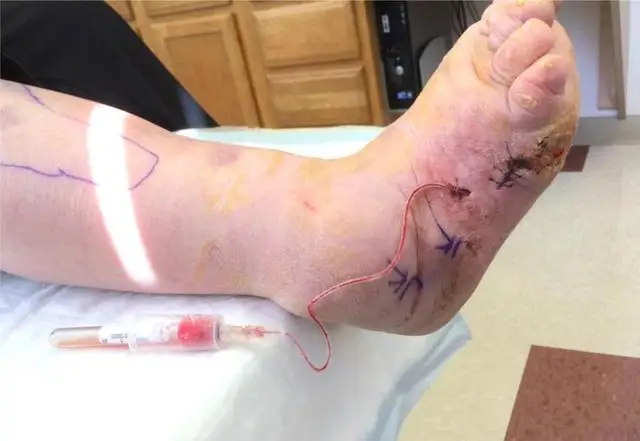 营业医院时间三间房怎么算_三间房医院营业时间_医院三点上班吗