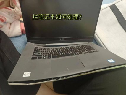 笔记本放在肚子上会不会有辐射-男性笔记本放在肚子上-图2