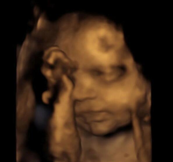 四维检查做多久_哪能做四维检查_能四维检查做四维吗