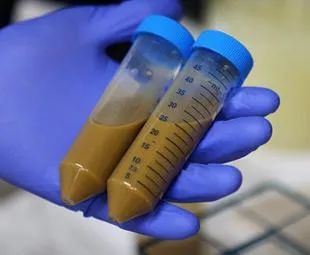 治疗克罗恩病的药_罗克罗恩病_罗克恩病能治好吗
