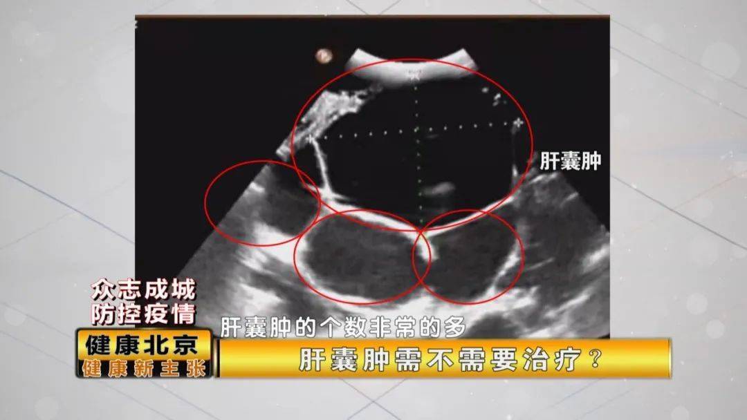 朝阳医院孙兵出诊时间_朝阳孙兵医生_北京朝阳医院孙文兵