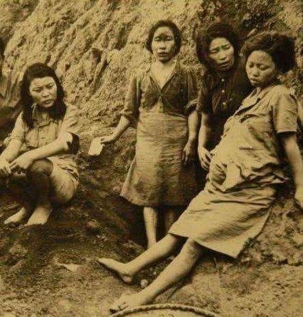 大便失禁肛门溃烂怎么办_慰安妇肛门撕裂大便失禁_大便失禁肛门皮肤破溃的护理