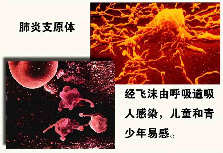 儿童肺炎支原体吃药能好吗_儿童支原体肺炎的治疗_肺炎治疗儿童支原体感染