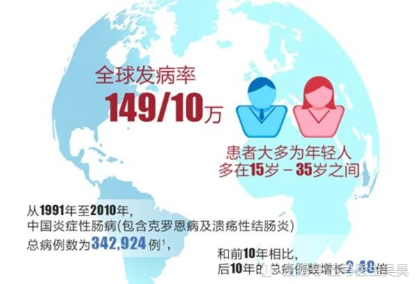 中国有多少克罗恩病人_罗克罗恩病_罗克恩病能治好吗