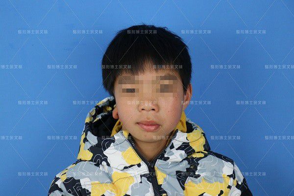 单克隆抗体病毒中和_克隆抗体检测是什么意思_呼吸道合胞病毒单克隆抗体