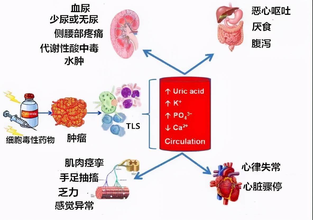 化疗期间感冒可以化疗吗_化疗后感冒咳嗽怎么办_感冒了化疗