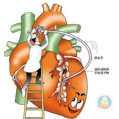 护理冠心病病人的心得体会_护理冠心病患者护理体会_冠心病护理的体会