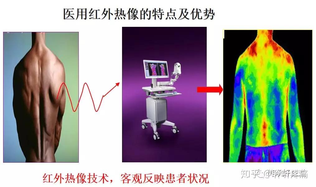 儿童肺炎治疗_儿童肺炎根治_儿童肺炎怎么治疗