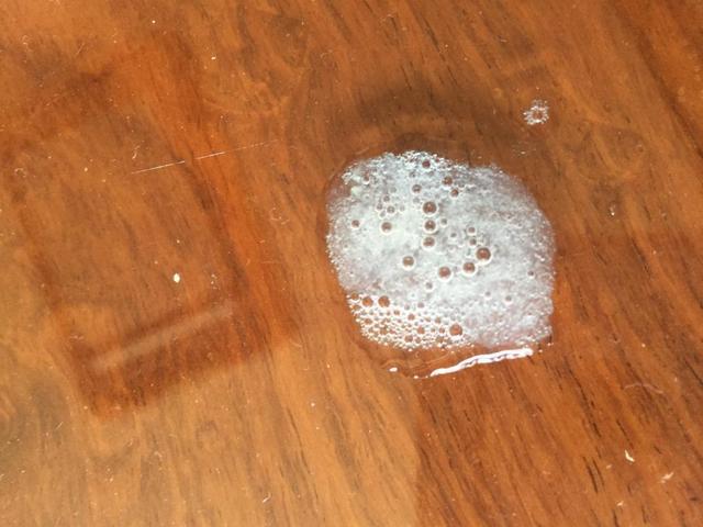 肺内有白痰_肺里白痰_肺里白痰多是怎么回事