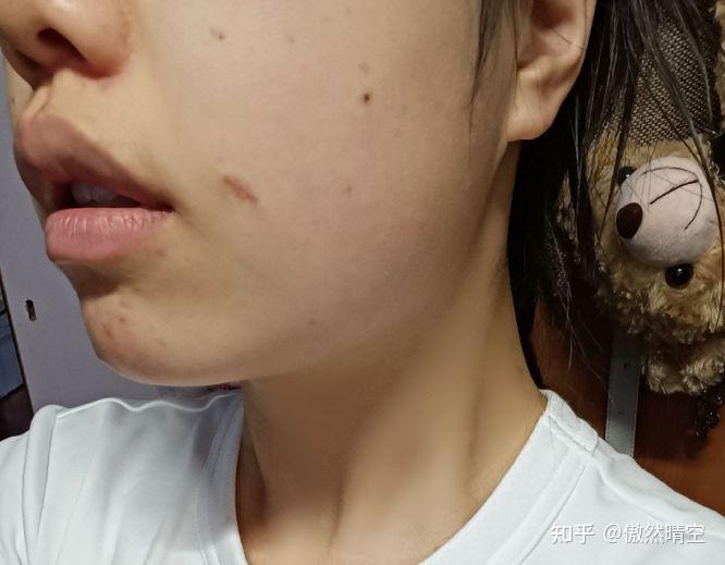 去版权局登记需要带什么_cmseasy去版权_去版权是什么意思