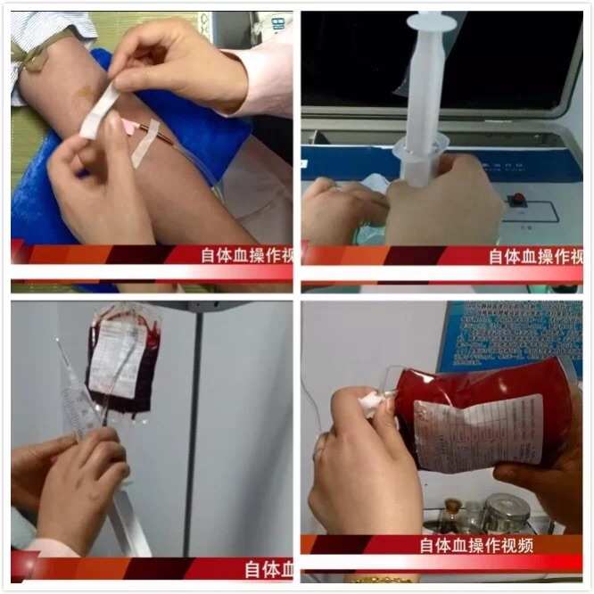 注射肛门大小失禁会臭氧流出吗_注射肛门大小失禁会臭氧吗_臭氧从肛门注射 会大小便失禁吗