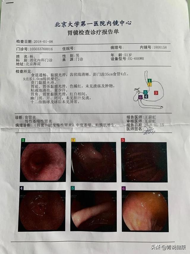 胃病吧天涯论坛_胃病天涯论坛_天涯论坛胃癌人间正道