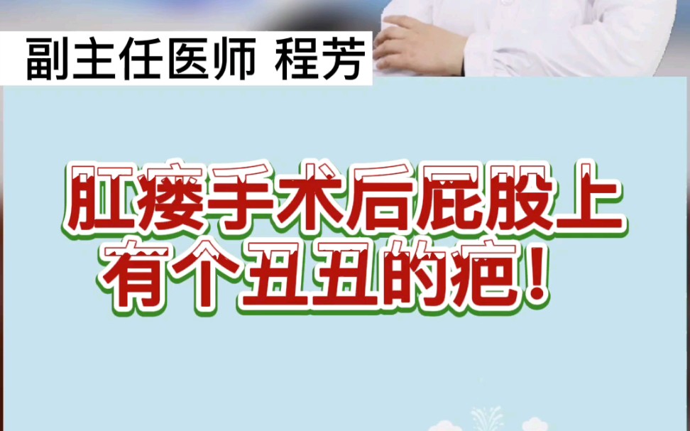 多长手术肛瘘时间用缝合_肛瘘手术多长时间不用换药_肛瘘手术用多长时间