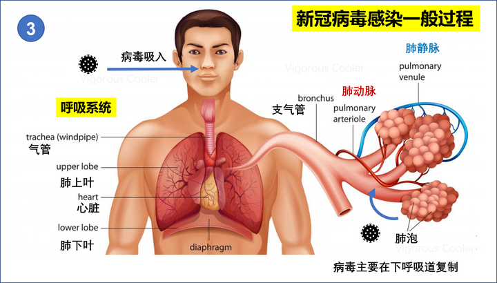 呼吸道合胞病毒的包涵体_呼吸合胞病毒表现_呼吸道合胞病毒缩写