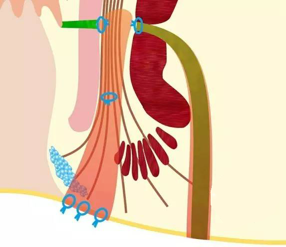 愈合手术肛瘘时间长吗_肛瘘手术愈合时间_肛瘘手术完全愈合需要多久