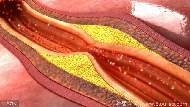 冠心病患者护理论文_冠心病护理论文参考文献_冠心病病人护理 论文