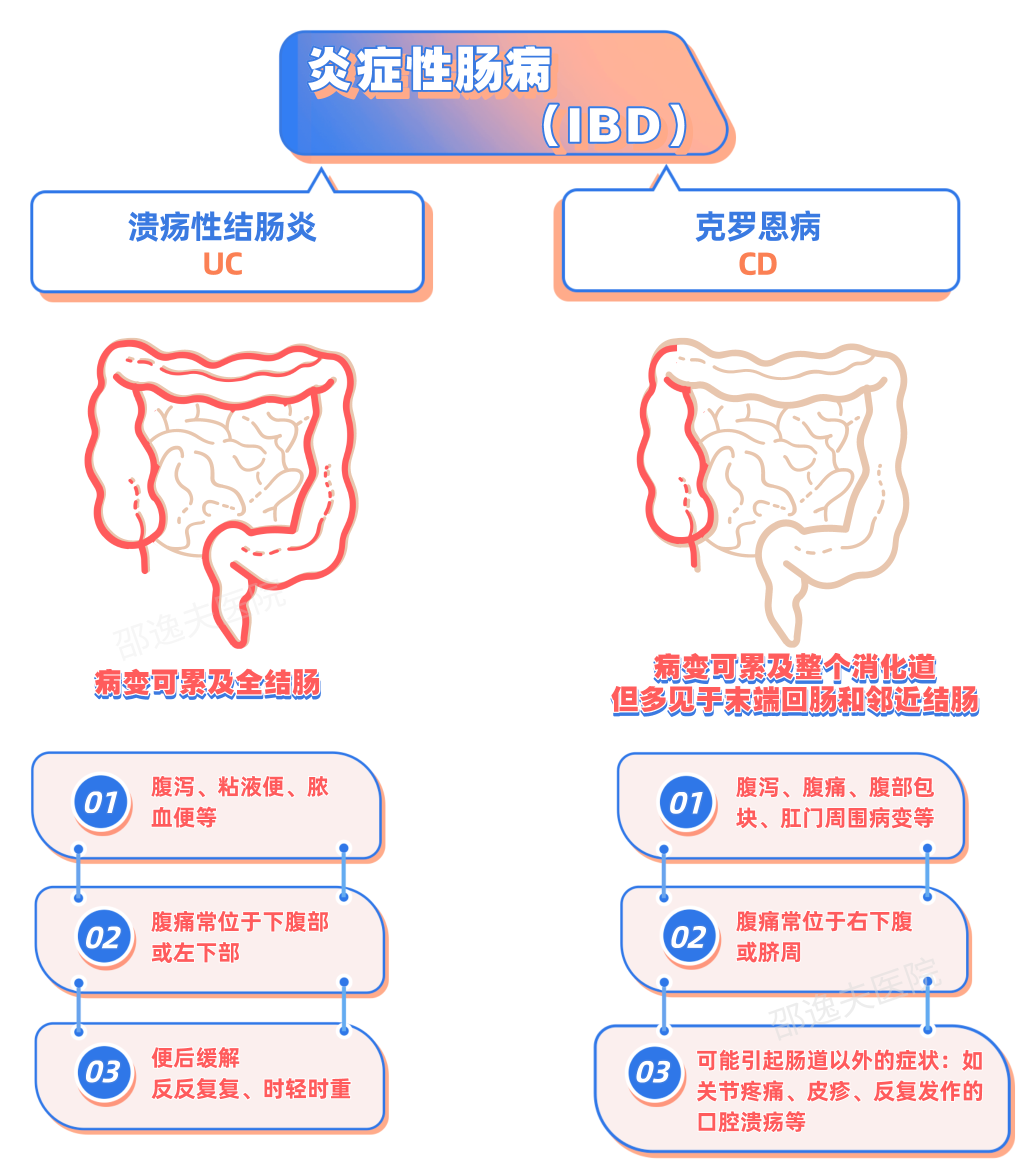 罗克恩病能治好吗_克罗恩治疗方法_罗克恩病早期症状