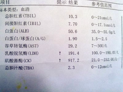 谷斌转氨酶化验