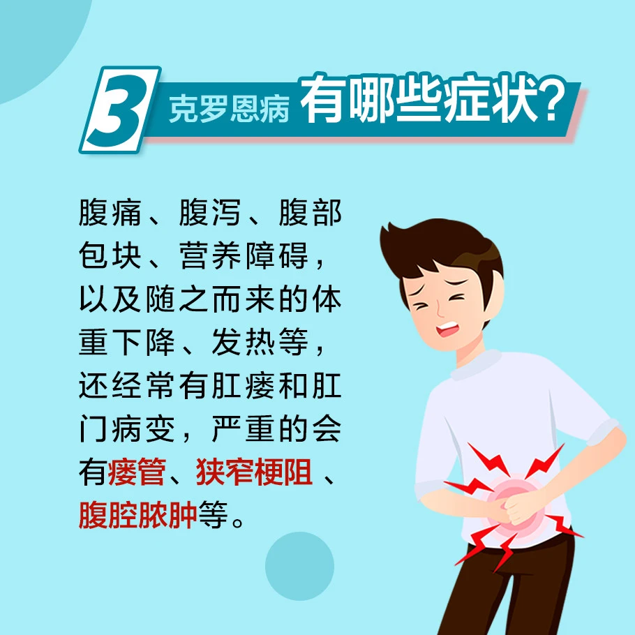 克罗恩病护理问题和护理诊断_克罗恩病并发症的护理_克罗恩病潜在并发症的护理措施