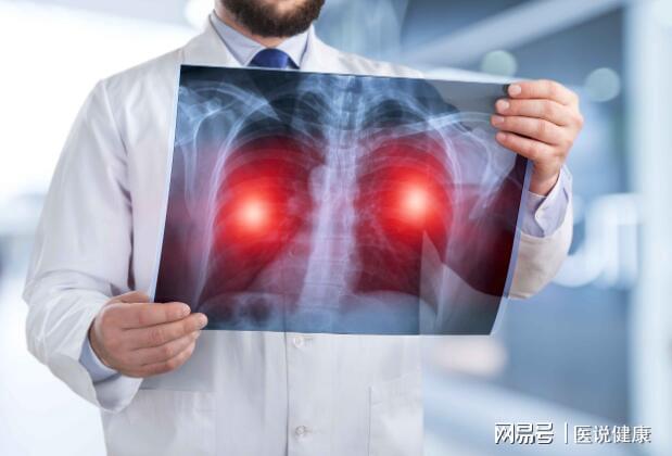 后背疼肺癌症状吗_后背疼痛肺癌_肺癌后背疼怎么回事