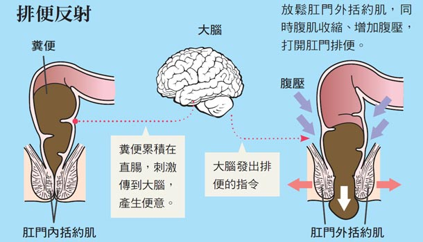 肛门括约肌失禁_肛门括约肌失禁手术几种_肛门括约肌失禁的鉴别诊断