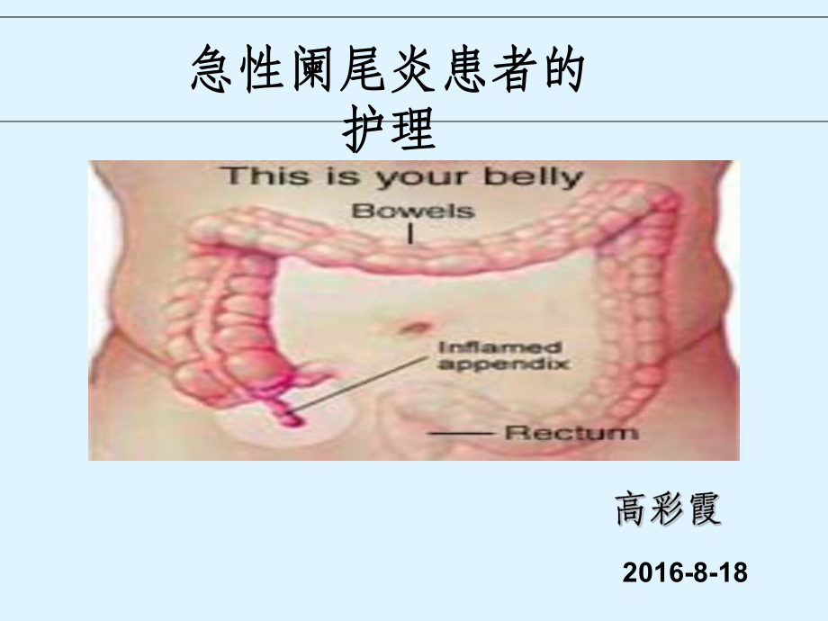 急性阑尾炎术后并发症护理_急性阑尾炎术后并发症护理_急性阑尾炎并发症的护理