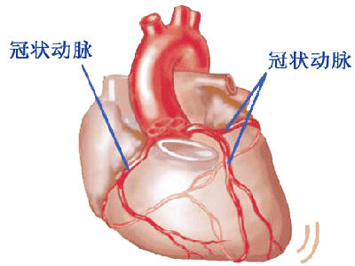 冠心病早期的特征