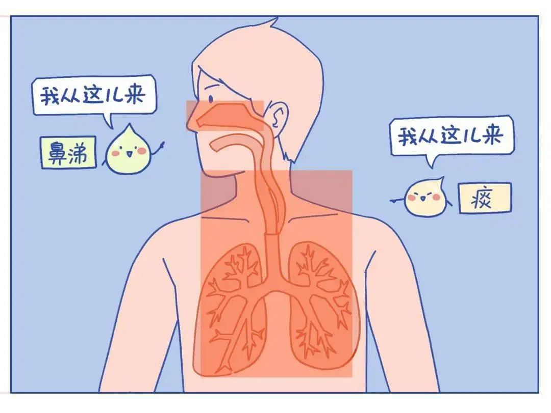 肺炎咳痰是白色的_肺炎咳嗽白痰好还是黄痰好_肺炎咳白痰