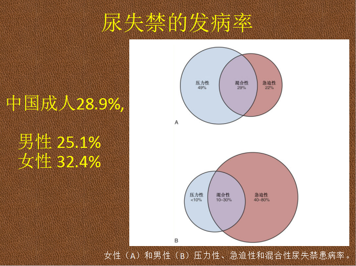 如何让肛门失禁_肛门失禁的症状在临床_肛门失禁患者