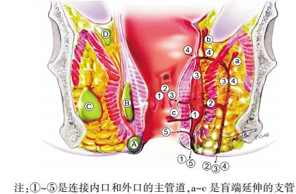 肛门病因失禁怎么治疗_肛门失禁最常见的并发症_肛门失禁病因