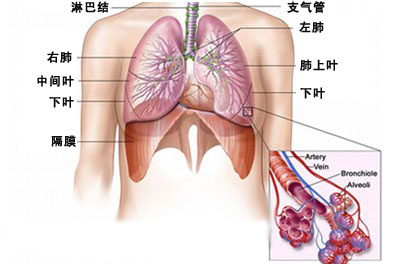 支气管炎