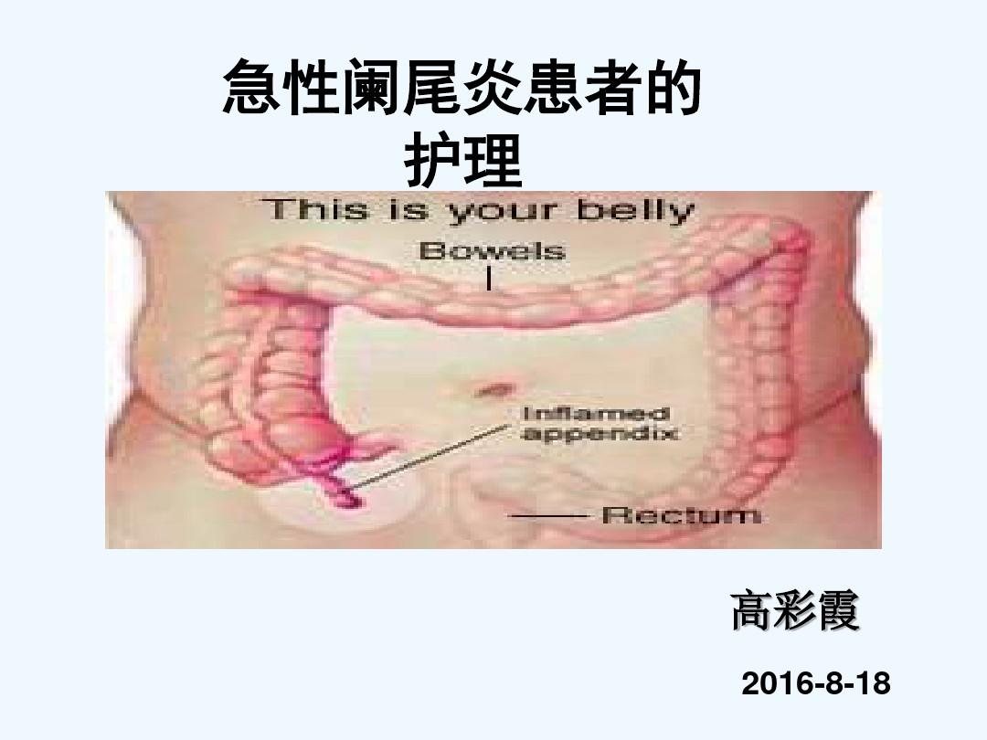 小儿急性阑尾炎护理措施_小儿急性阑尾炎术后护理_小儿急性阑尾炎术后护理