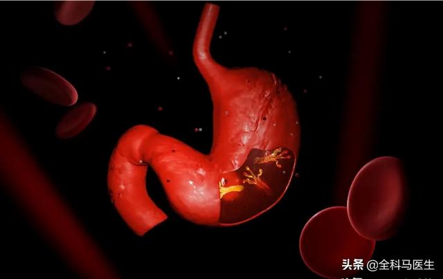 慢性胃溃疡的中医治疗_慢性胃中医治疗溃疡效果好吗_慢性胃中医治疗溃疡的方剂