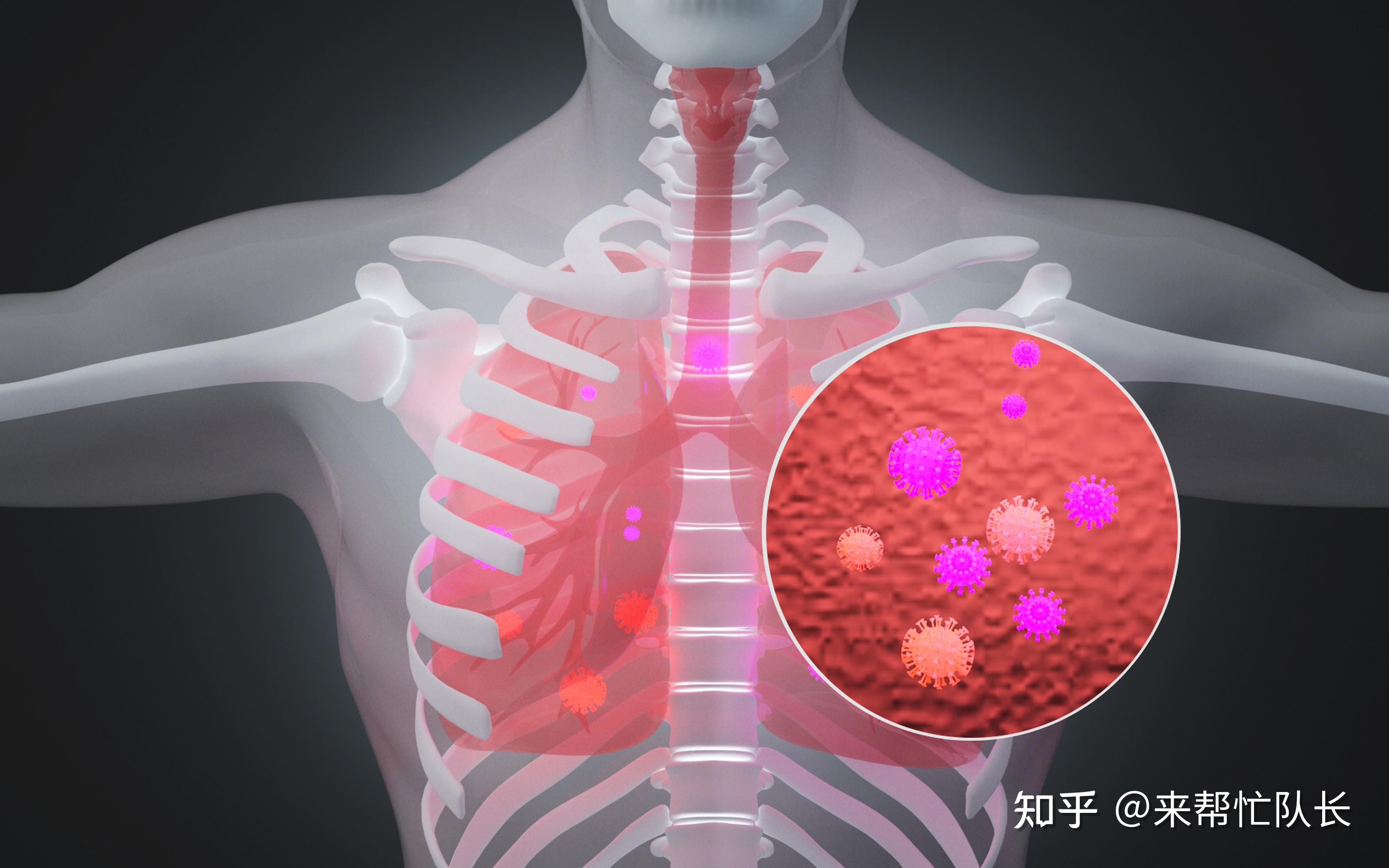 肺症状结核型有哪些_肺结核典型症状是_三型肺结核症状有哪些