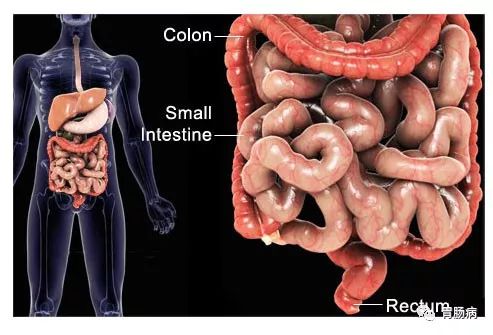 克罗恩病克罗恩肠炎治疗_肠炎克罗恩_罗克恩病能治好吗