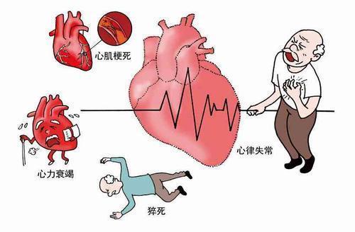 冠心病患者的护理课件_冠心病护理课件_冠心病护理ppt课件免费