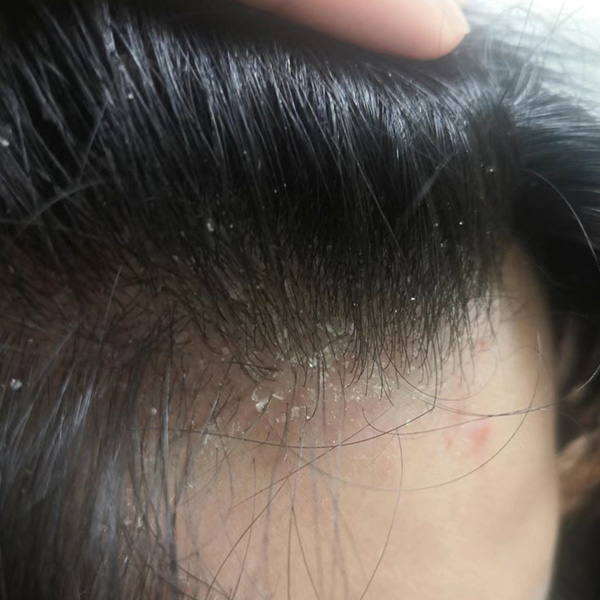 血毒丸的功效与作用_血毒丸多少钱_血毒丸的成分