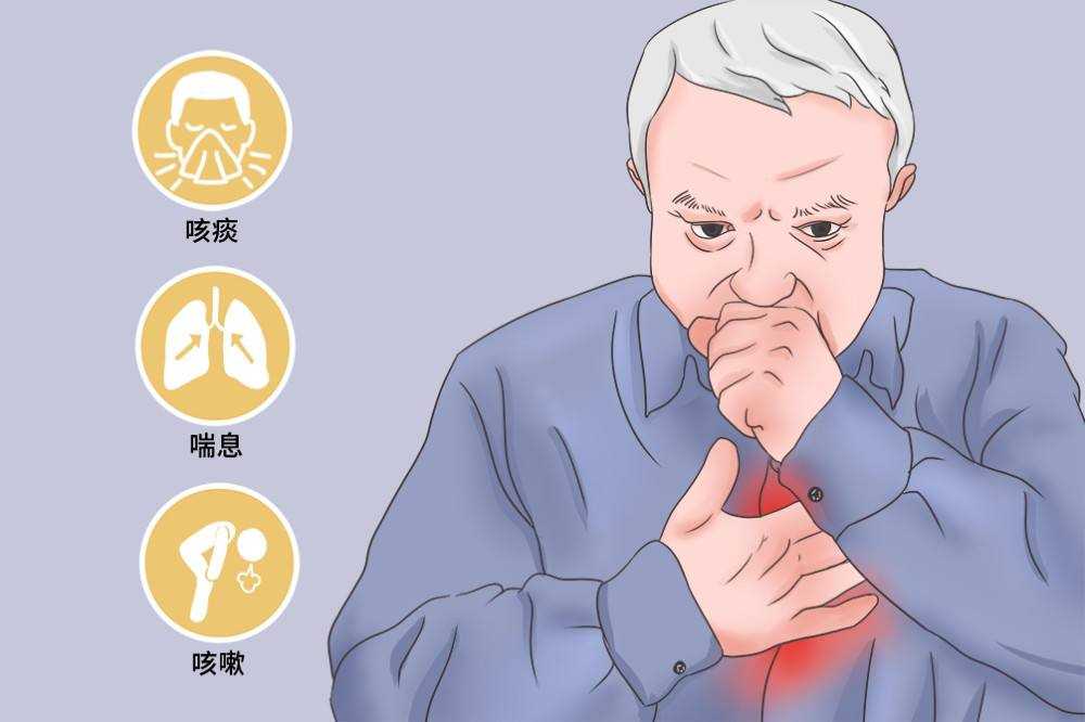 支气管炎症治疗需要多久_支气管炎治疗时间_气管炎疗程