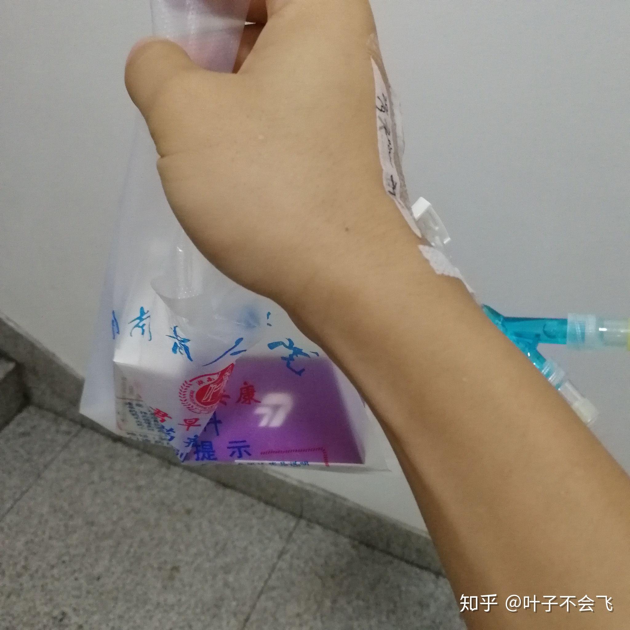 罗克恩病能治好吗_治疗克罗恩病的药物_药物病治疗罗恩克菌的原理