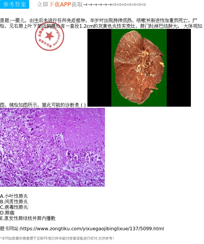 肺结核咳痰白色_肺结核 白痰_肺结核白痰黄痰的图片