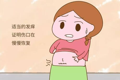 刨腹产后感冒咳嗽还可以母乳吗_剖腹产后感冒咳嗽怎么办_产妇感冒咳嗽可以吃药吗