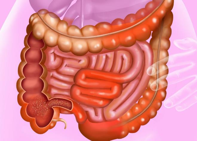 中医治疗罗恩克病的方法_中医治疗克罗恩_治疗克罗恩的中医药方