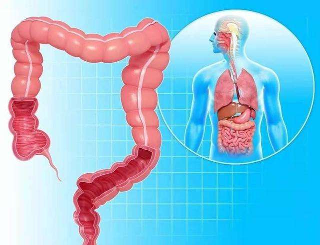 肠炎克罗恩病_克罗恩肠炎跟一般肠炎的区别_克罗恩肠炎的症状