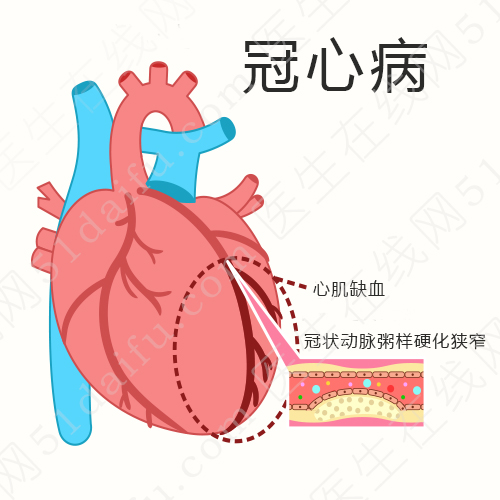 冠心病介入性治疗_冠心病介入诊疗_冠心病介入治疗病例