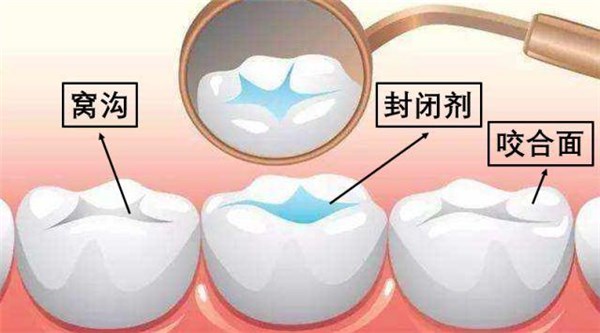 犇牛病毒传播途径_犇牛病毒现在还有吗_最近牛病毒