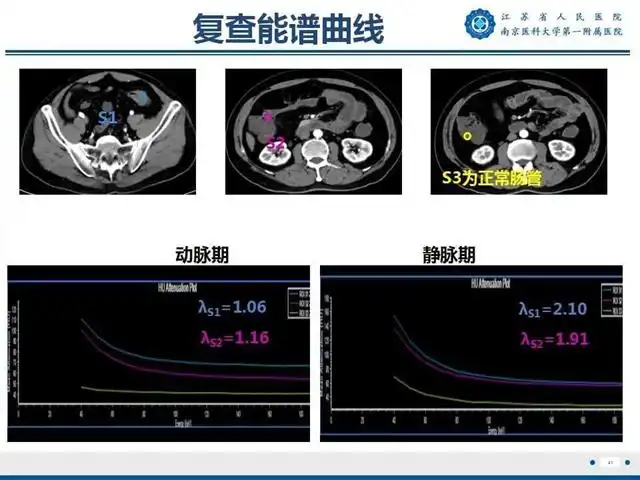 克罗恩的护理查房_克罗恩护理常规ppt_克罗恩护理查房ppt