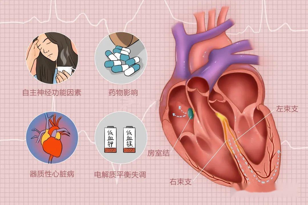 完全性卒中进展性卒中_完全性卒中_完全性卒中定义